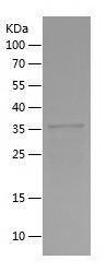    NR2E3 / Recombinant Human NR2E3