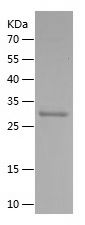    SLC34A2 / Recombinant Human SLC34A2