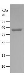    SERPINH1 / Recombinant Human SERPINH1