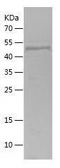    MYH9 / Recombinant Human MYH9