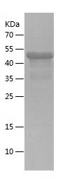    PABPC1 / Recombinant Human PABPC1