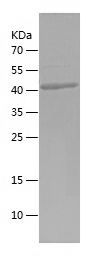    NXF1 / Recombinant Human NXF1