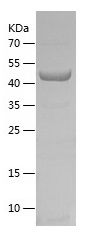    P4HA1 / Recombinant Human P4HA1