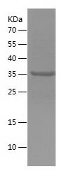    MYL1 / Recombinant Human MYL1