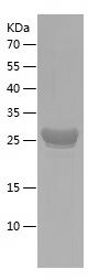    OLIG2 / Recombinant Human OLIG2