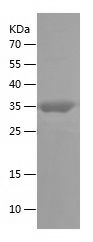    NPHS2 / Recombinant Human NPHS2