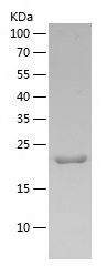    M-CSF / Recombinant Human M-CSF