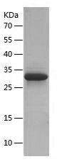    ZNT8 / Recombinant Human ZNT8