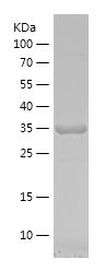    NAGA / Recombinant Human NAGA