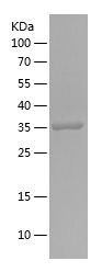    ADH5 / Recombinant Human ADH5