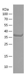    NTNG1 / Recombinant Human NTNG1