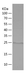    IVL / Recombinant Human IVL