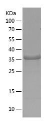    RARA / Recombinant Human RARA