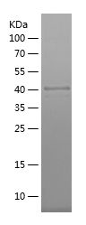    SLCO4C1 / Recombinant Human SLCO4C1