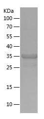    RIOK3 / Recombinant Human RIOK3