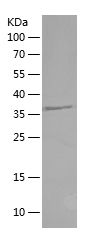    SPAG4L / Recombinant Human SPAG4L