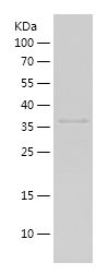    RPLP0 / Recombinant Human RPLP0