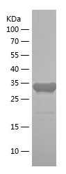    PYCR2 / Recombinant Human PYCR2