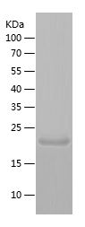    RTN1 / Recombinant Human RTN1