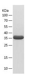    PHOX2B / Recombinant Human PHOX2B