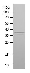    TWIST1 / Recombinant Human TWIST1