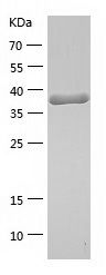    PRDX4 / Recombinant Human PRDX4