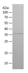    SPATA1 / Recombinant Human SPATA1