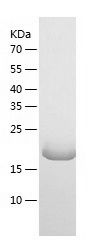    MOK / Recombinant Human MOK