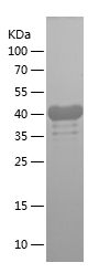    RHAMM / Recombinant Human RHAMM