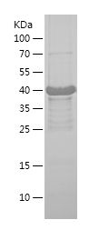    SNX17 / Recombinant Human SNX17