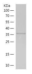    RB1CC1 / Recombinant Human RB1CC1