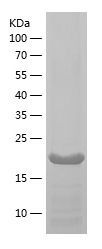    MMP9 / Recombinant Human MMP9