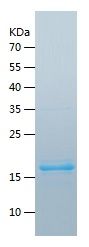    CAVIN2 / Recombinant Human CAVIN2