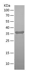    SLITRK6 / Recombinant Human SLITRK6