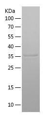    PYGL / Recombinant Human PYGL