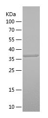    SPINT1 / Recombinant Human SPINT1