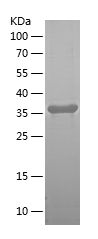    SGLT3 / Recombinant Human SGLT3