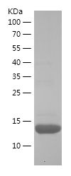    S100A8 / Recombinant Human S100A8