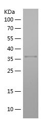    HNRNPA3 / Recombinant Human HNRNPA3