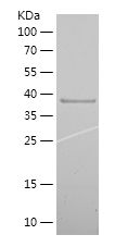    MAP2 / Recombinant Human MAP2