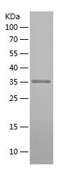    SMN / Recombinant Human SMN