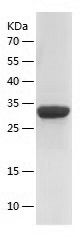    S100A10 / Recombinant Human S100A10