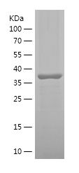    STT3A / Recombinant Human STT3A