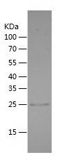    APCS / Recombinant Human APCS