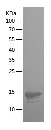    ITGB7 / Recombinant Human ITGB7