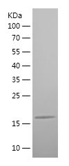    CX3CL1 / Recombinant Human CX3CL1