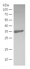    RNASET2 / Recombinant Human RNASET2