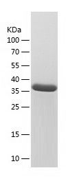    CD39 / Recombinant Human CD39