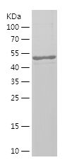    PAPD5 / Recombinant Human PAPD5