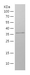    CD36 / Recombinant Human CD36